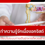 ทำความรู้จักเนื้องอกจิสต์ ภัยเงียบในระบบทางเดินอาหารที่ควรเฝ้าระวัง