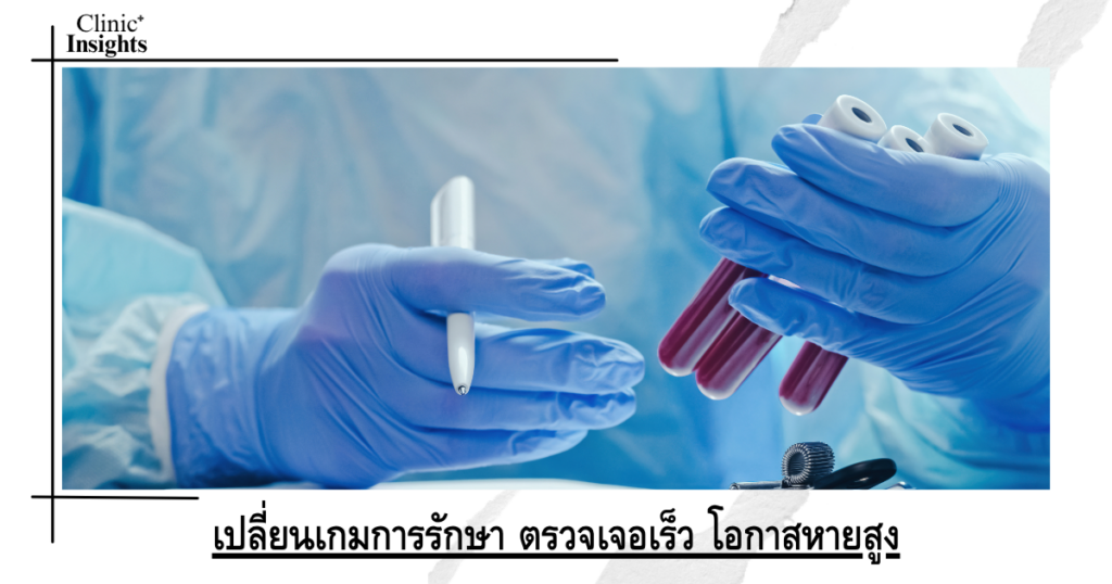 เปลี่ยนเกมการรักษา ตรวจเจอเร็ว โอกาสหายสูง