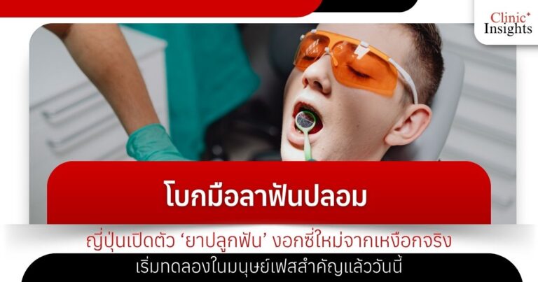 โบกมือลาฟันปลอม ญี่ปุ่นเปิดตัว ‘ยาปลูกฟัน’ งอกซี่ใหม่จากเหงือกจริง