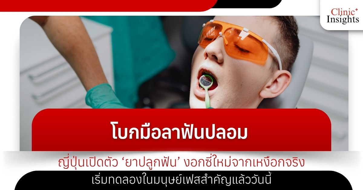 โบกมือลาฟันปลอม ญี่ปุ่นเปิดตัว ‘ยาปลูกฟัน’ งอกซี่ใหม่จากเหงือกจริง